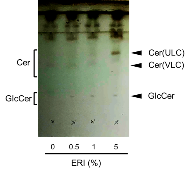 図２　薄層クロマトグラフィーを用いた高機能還元性イオン水（ERI）によるセラミドとグルコシルセラミドの生合成結果